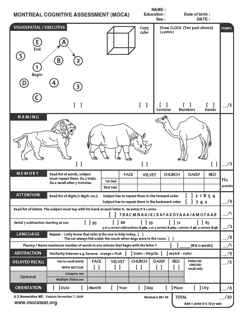  image of the montreal cognitive assessment or MOCA test that could be used to determine brain fog
