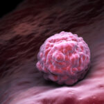 Why are cancer cells immortal?